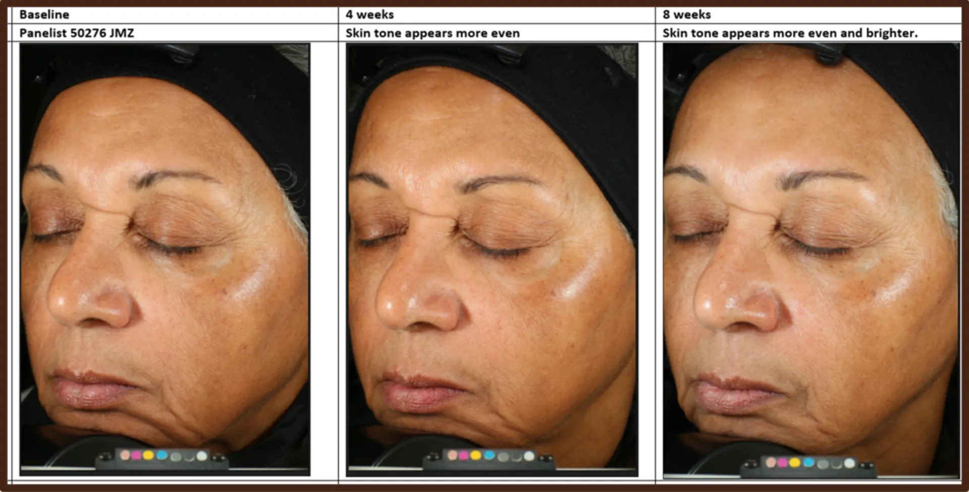 Advanced Fade Cream Hydroquinone-Free