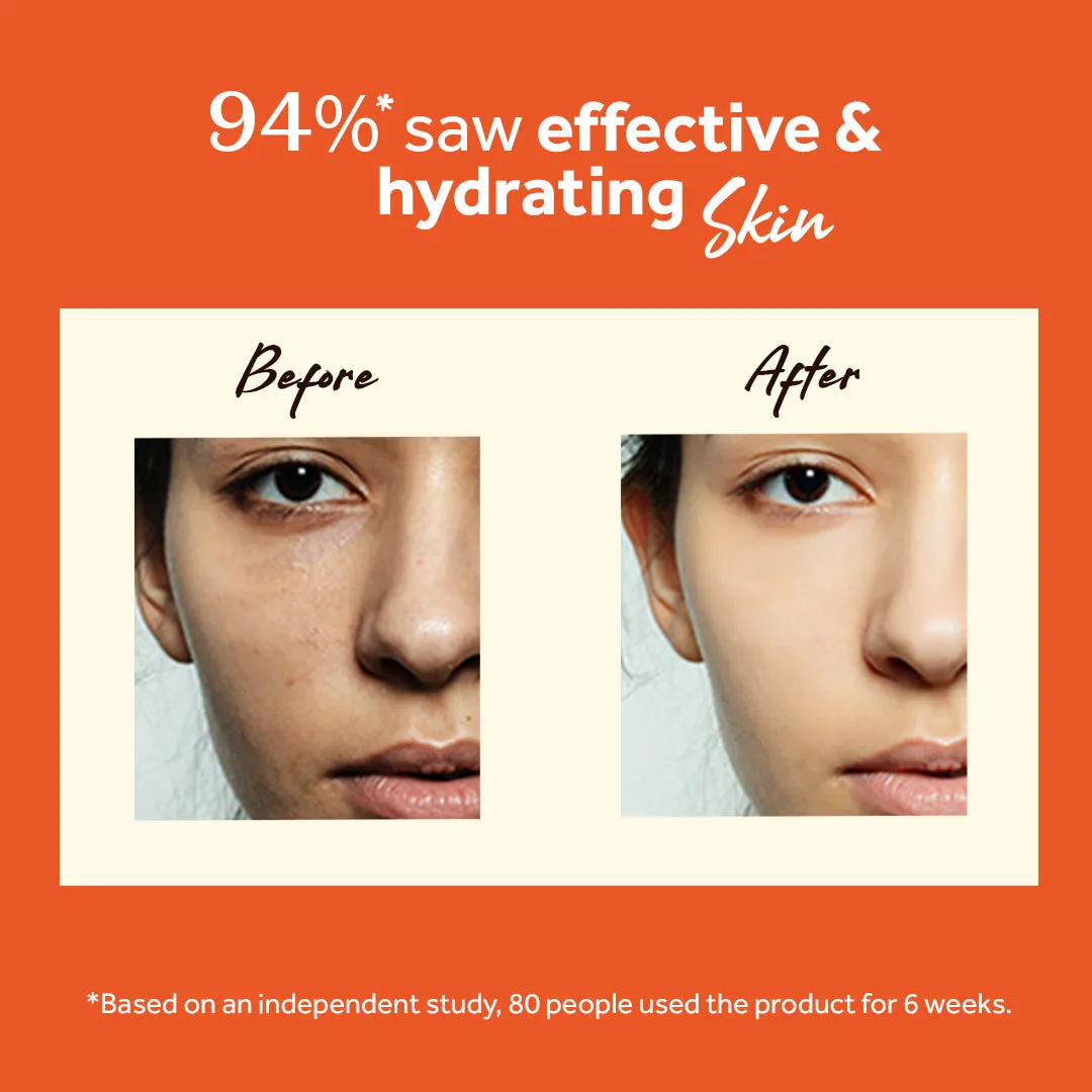 atulya Vitamin C Face Serum 30ml (Buy 5 Products & Get Rs.500 Off)