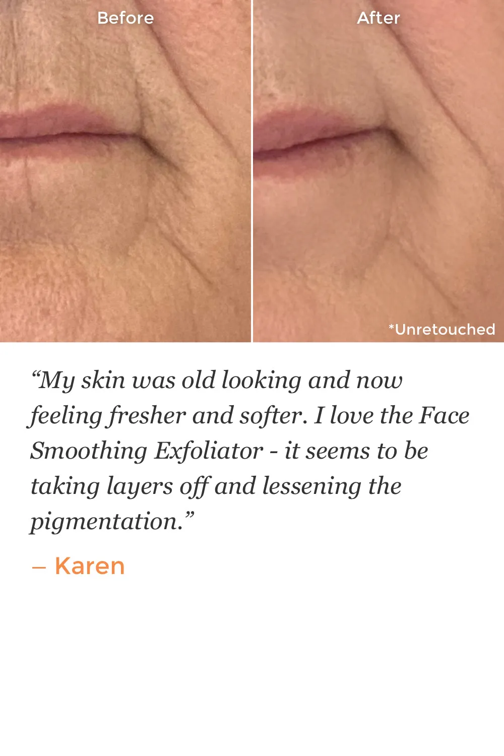 Face Smoothing Exfoliator