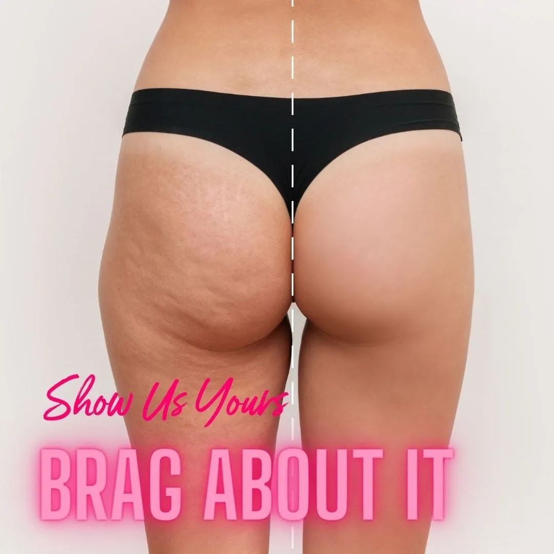NEW Cellulite Glycolic Body Scrub-Berry My Butt Smoothie